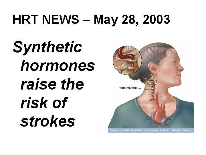 HRT NEWS – May 28, 2003 Synthetic hormones raise the risk of strokes 