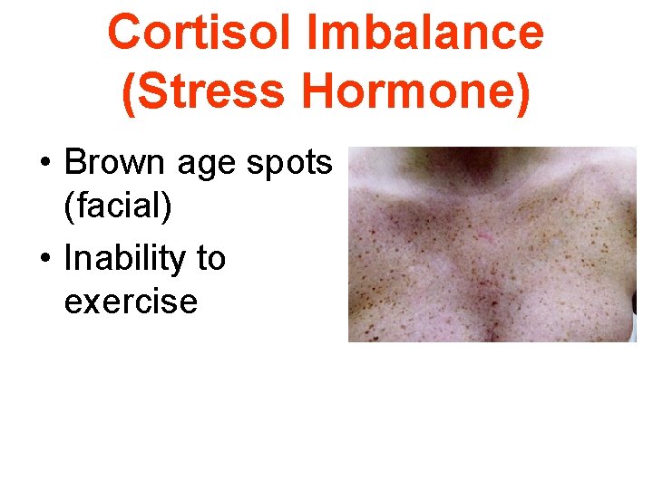 Cortisol Imbalance (Stress Hormone) • Brown age spots (facial) • Inability to exercise 