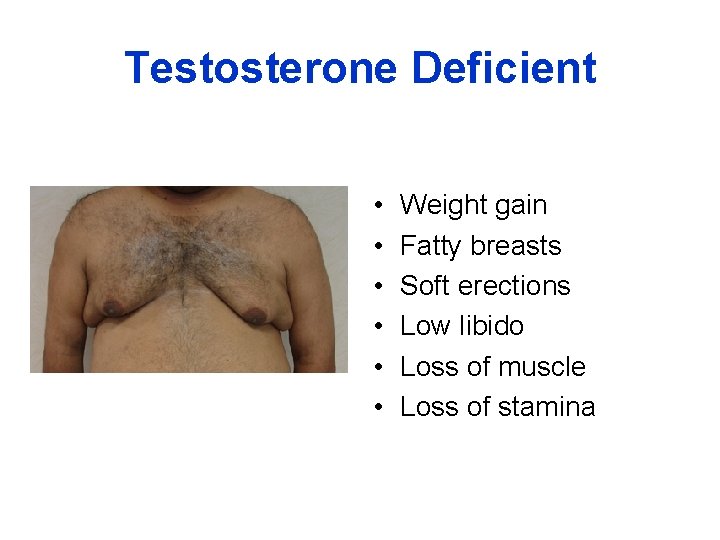 Testosterone Deficient • • • Weight gain Fatty breasts Soft erections Low libido Loss