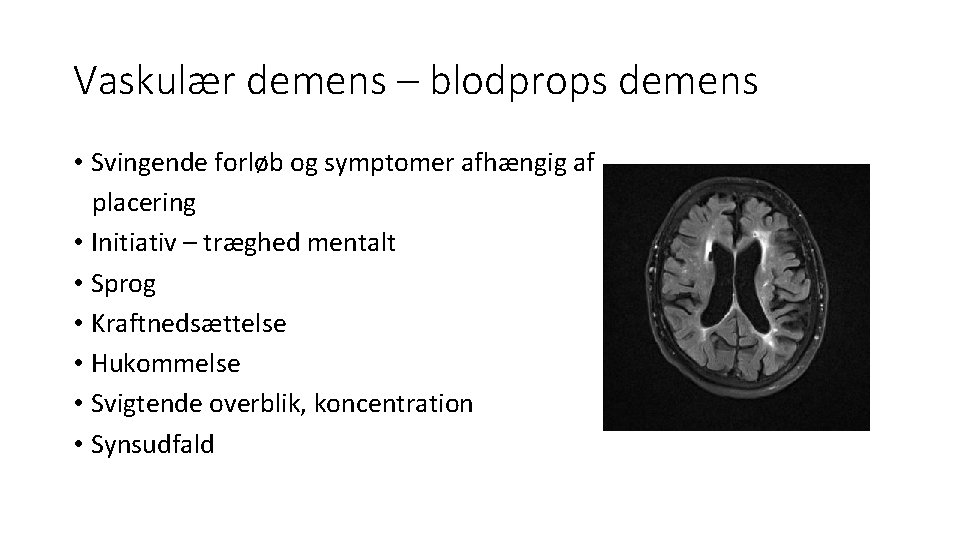 Mennesket Bag Demensen Aktiviteter Til Demente Tema Dag mennesket-bag-demensen-aktiviteter-til-demente-tema-dag