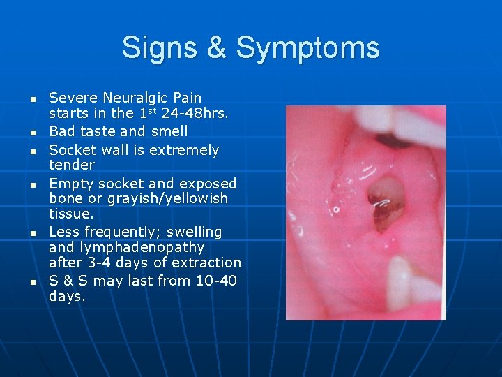 Signs & Symptoms n n n Severe Neuralgic Pain starts in the 1 st