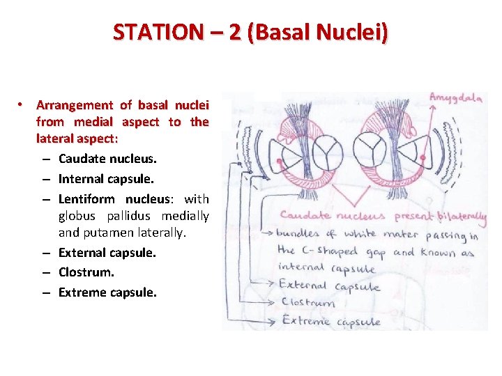 STATION – 2 (Basal Nuclei) • Arrangement of basal nuclei from medial aspect to