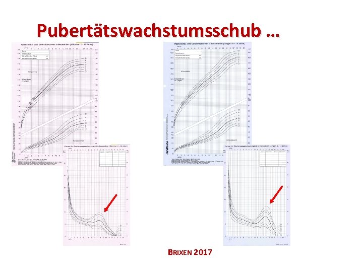 Pubertätswachstumsschub … BRIXEN 2017 