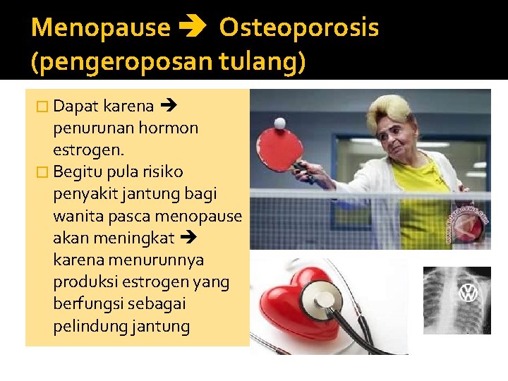 Menopause Osteoporosis (pengeroposan tulang) � Dapat karena penurunan hormon estrogen. � Begitu pula risiko