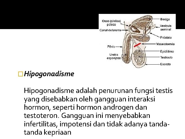 �Hipogonadisme adalah penurunan fungsi testis yang disebabkan oleh gangguan interaksi hormon, seperti hormon androgen