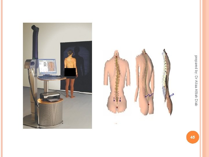 prepared by: Dr Aliaa Attiah Diab 45 