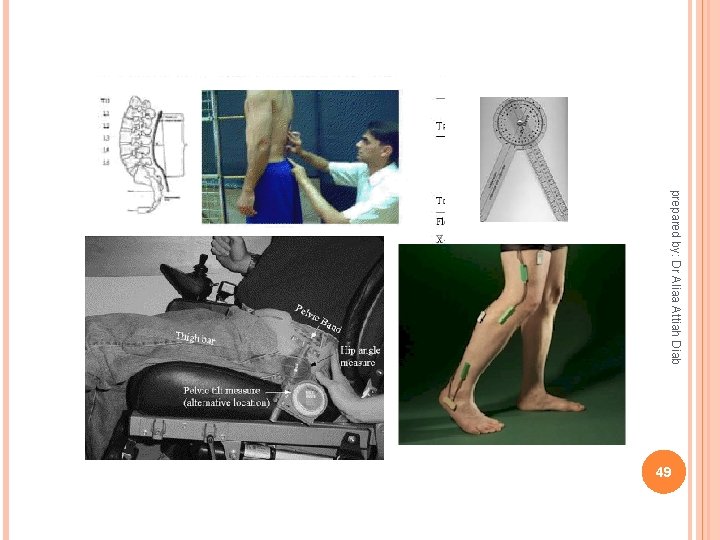 prepared by: Dr Aliaa Attiah Diab 49 