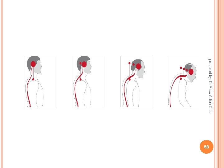 prepared by: Dr Aliaa Attiah Diab 58 