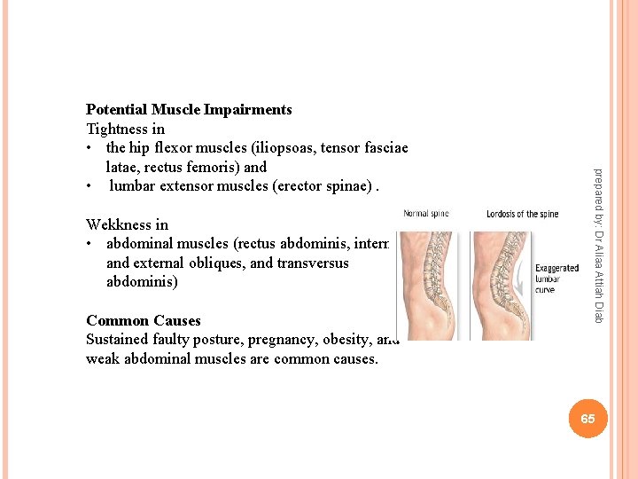 Wekkness in • abdominal muscles (rectus abdominis, internal and external obliques, and transversus abdominis)