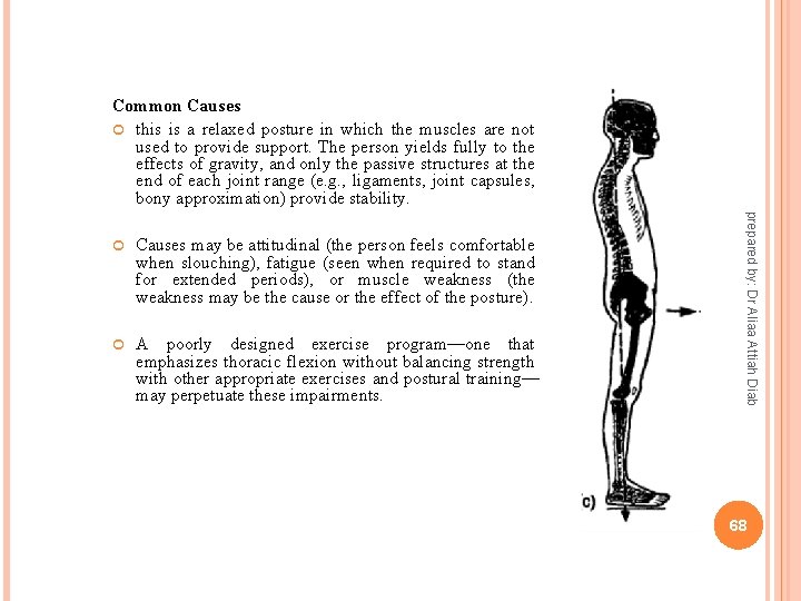 Common Causes this is a relaxed posture in which the muscles are not used