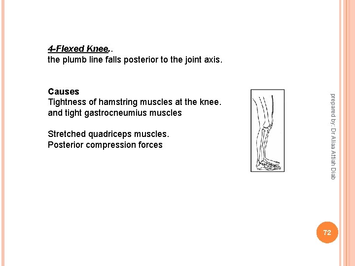 4 -Flexed Knee. . the plumb line falls posterior to the joint axis. Stretched