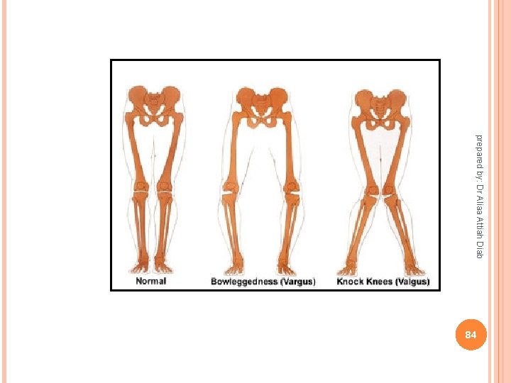prepared by: Dr Aliaa Attiah Diab 84 