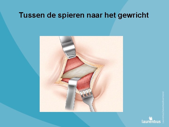 Tussen de spieren naar het gewricht 