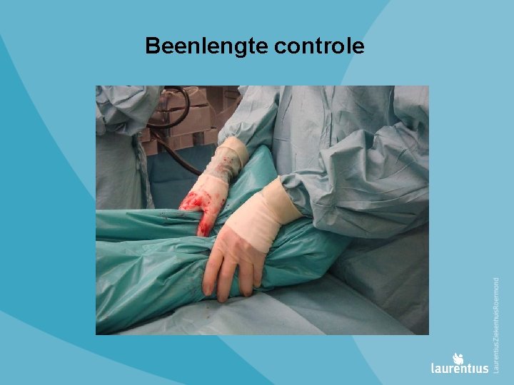 Beenlengte controle 