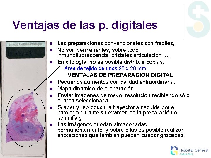 Ventajas de las p. digitales l l l Las preparaciones convencionales son frágiles, No