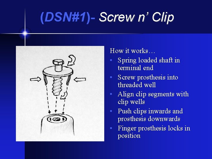 (DSN#1)- Screw n’ Clip How it works… • Spring loaded shaft in terminal end