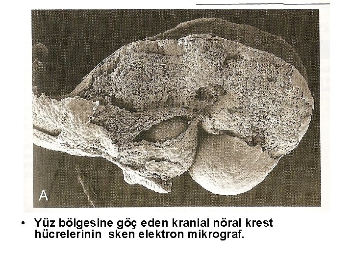  • Yüz bölgesine göç eden kranial nöral krest hücrelerinin sken elektron mikrograf. 