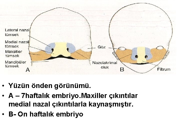  • Yüzün önden görünümü. • A – 7 haftalık embriyo. Maxiller çıkıntılar medial