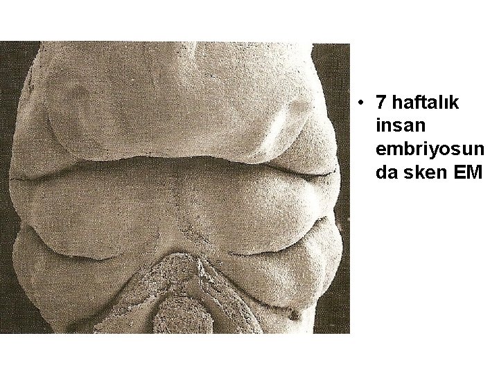  • 7 haftalık insan embriyosun da sken EM 