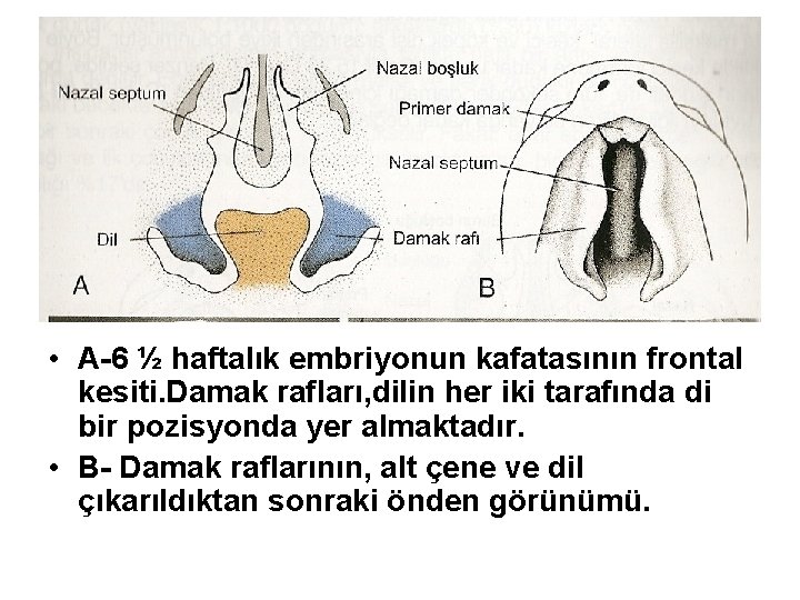  • A-6 ½ haftalık embriyonun kafatasının frontal kesiti. Damak rafları, dilin her iki