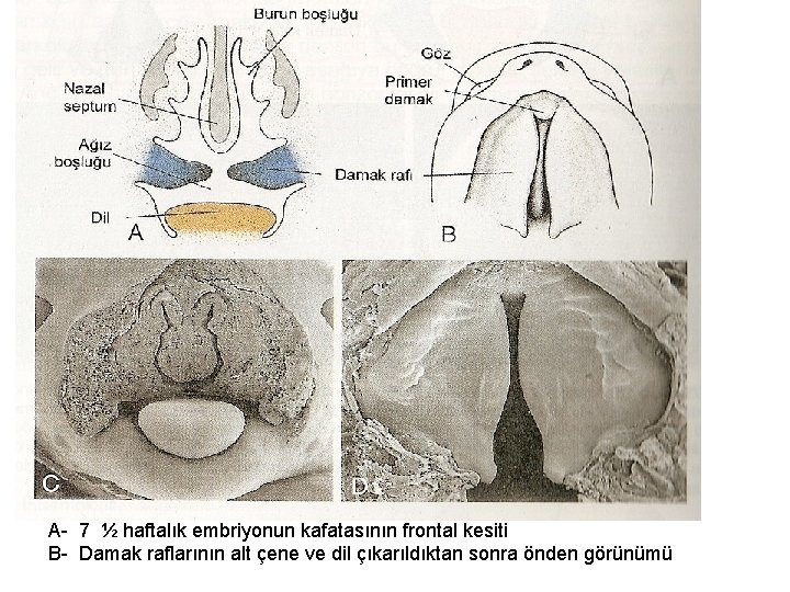 A- 7 ½ haftalık embriyonun kafatasının frontal kesiti B- Damak raflarının alt çene ve