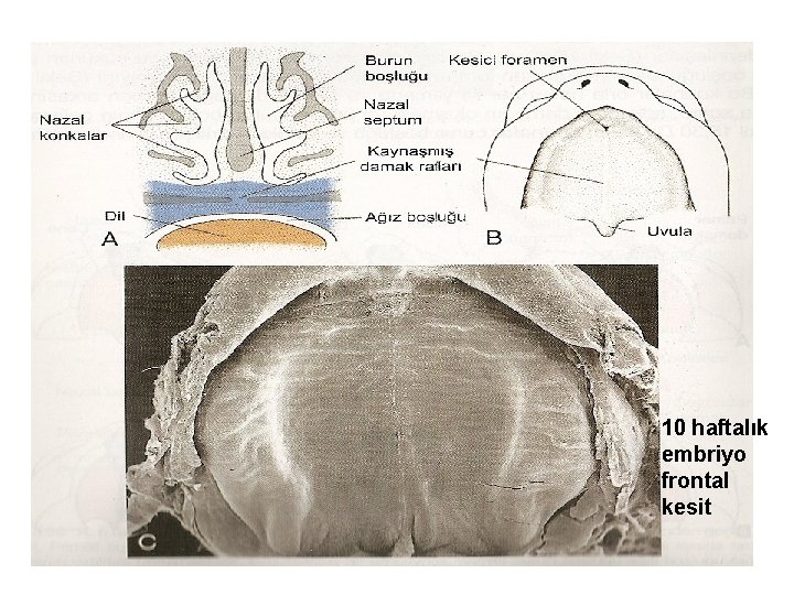 10 haftalık embriyo frontal kesit 