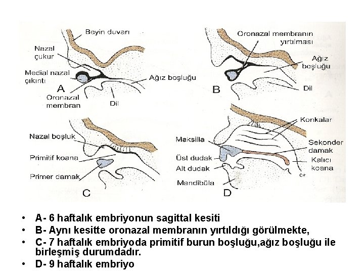  • A- 6 haftalık embriyonun sagittal kesiti • B- Aynı kesitte oronazal membranın