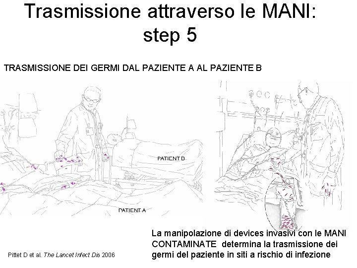 Trasmissione attraverso le MANI: step 5 TRASMISSIONE DEI GERMI DAL PAZIENTE A AL PAZIENTE