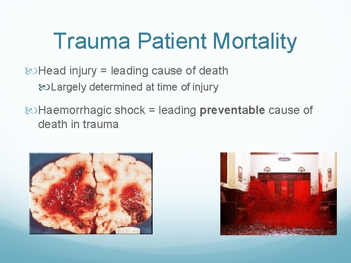Trauma Patient Mortality Head injury = leading cause of death Largely determined at time