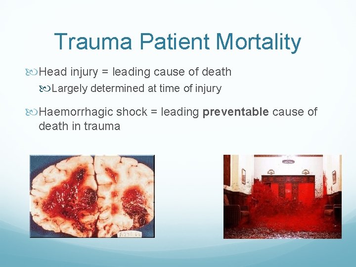 Trauma Patient Mortality Head injury = leading cause of death Largely determined at time Trauma Patient Mortality Head injury = leading cause of death Largely determined at time