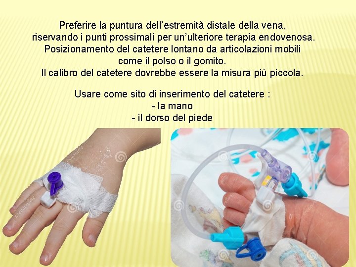 Preferire la puntura dell’estremità distale della vena, riservando i punti prossimali per un’ulteriore terapia