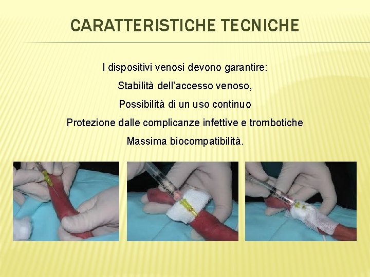 CARATTERISTICHE TECNICHE I dispositivi venosi devono garantire: Stabilità dell’accesso venoso, Possibilità di un uso