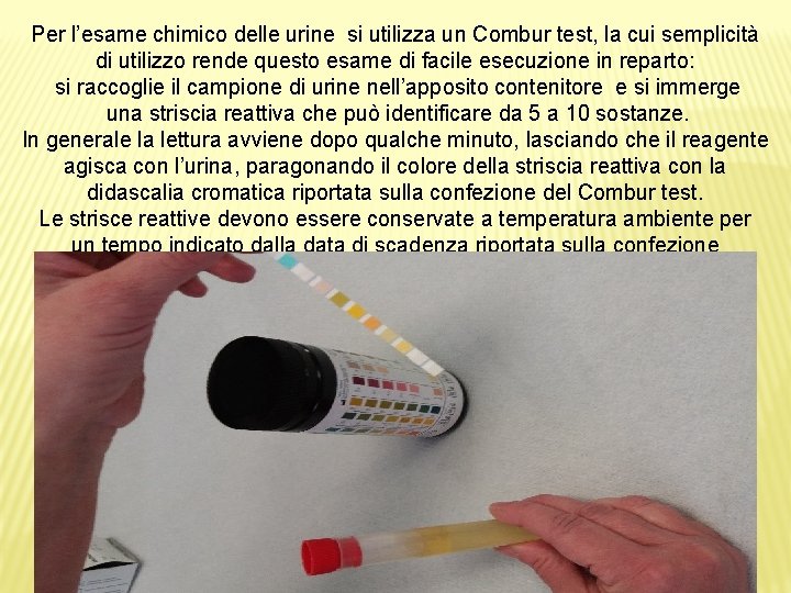 Per l’esame chimico delle urine si utilizza un Combur test, la cui semplicità di