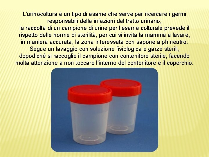 L’urinocoltura è un tipo di esame che serve per ricercare i germi responsabili delle