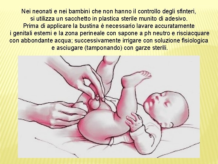 Nei neonati e nei bambini che non hanno il controllo degli sfinteri, si utilizza