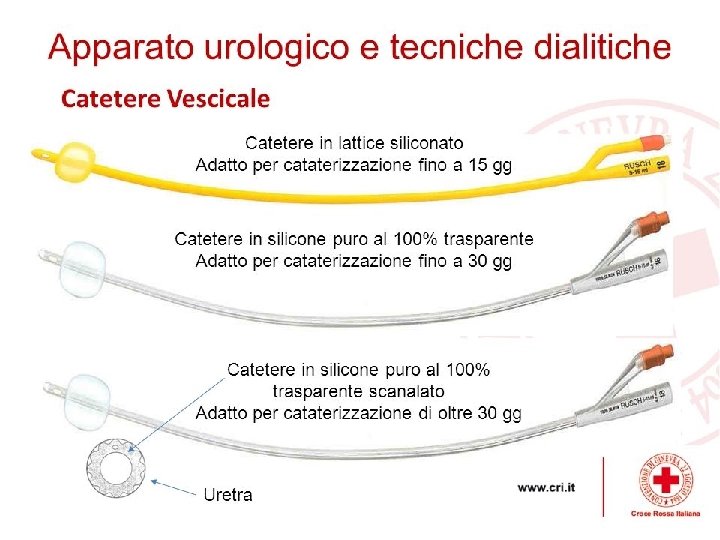 Il cateterismo vescicale può essere permanente, intermittente, occasionale. A seconda del tipo di cateterismo