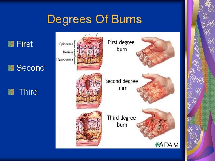Degrees Of Burns First Second Third 