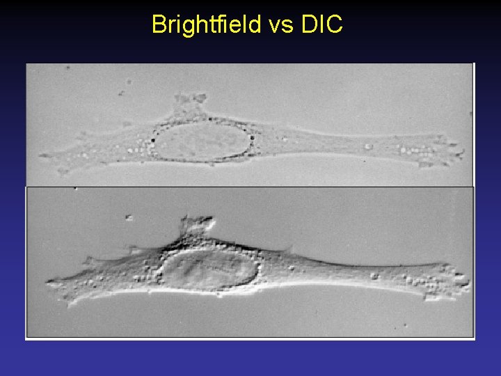 Brightfield vs DIC 