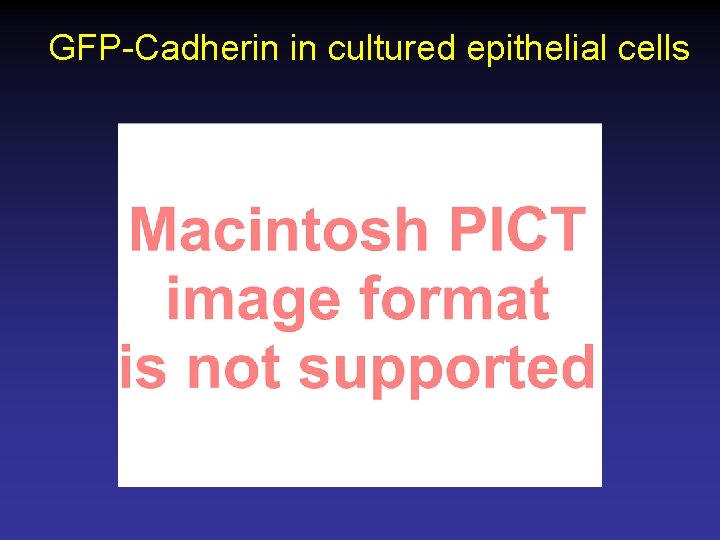 GFP-Cadherin in cultured epithelial cells 