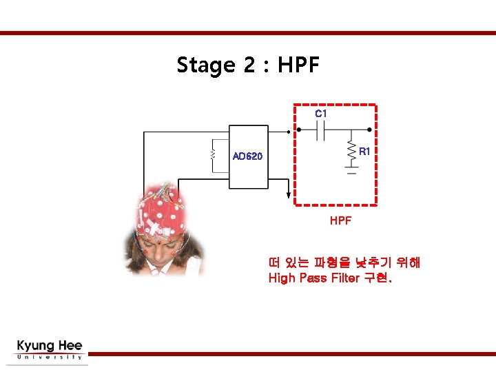 Stage 2 : HPF C 1 R 1 AD 620 HPF 떠 있는 파형을