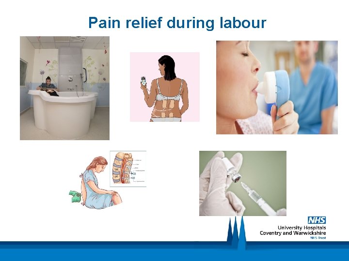 Pain relief during labour 