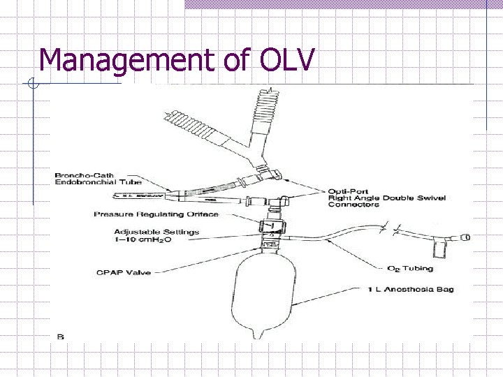 Management of OLV 