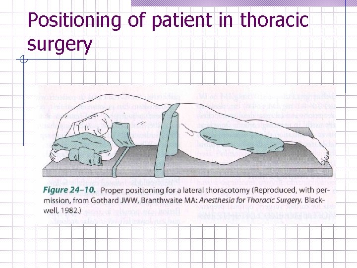 Positioning of patient in thoracic surgery 