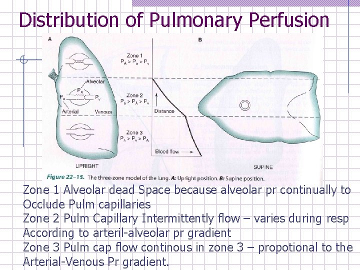 Distribution of Pulmonary Perfusion Zone 1 Alveolar dead Space because alveolar pr continually to