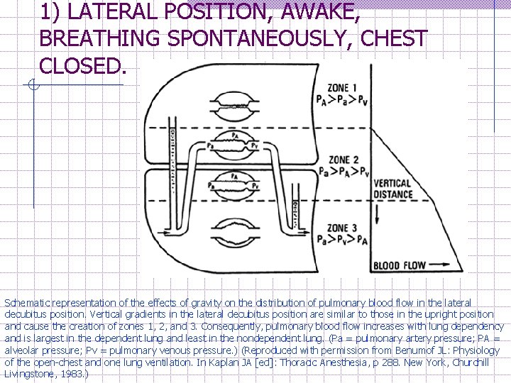 1) LATERAL POSITION, AWAKE, BREATHING SPONTANEOUSLY, CHEST CLOSED. Schematic representation of the effects of