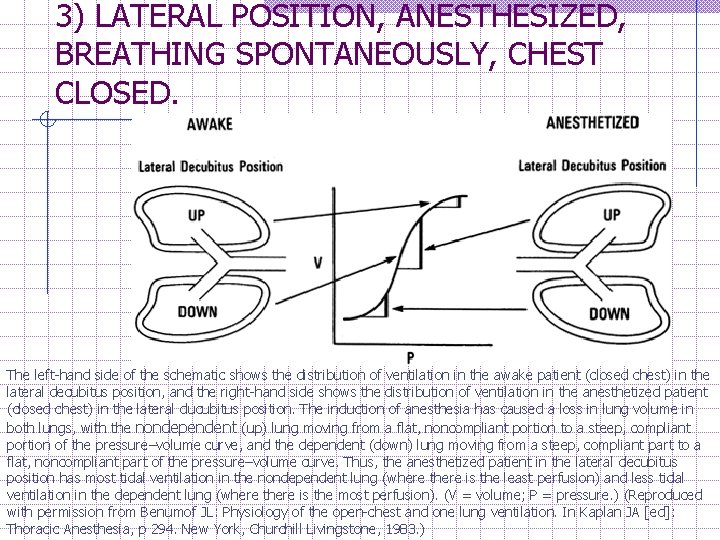3) LATERAL POSITION, ANESTHESIZED, BREATHING SPONTANEOUSLY, CHEST CLOSED. The left-hand side of the schematic