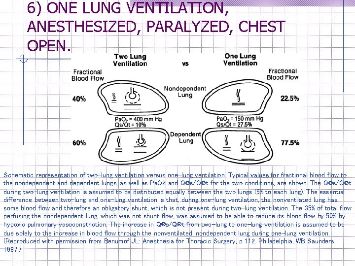 6) ONE LUNG VENTILATION, ANESTHESIZED, PARALYZED, CHEST OPEN. Schematic representation of two-lung ventilation versus