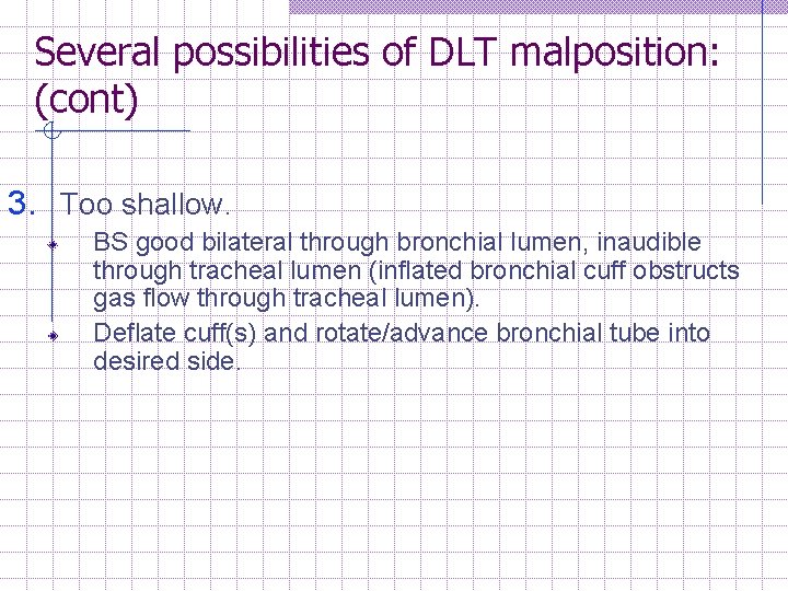 Several possibilities of DLT malposition: (cont) 3. Too shallow. BS good bilateral through bronchial
