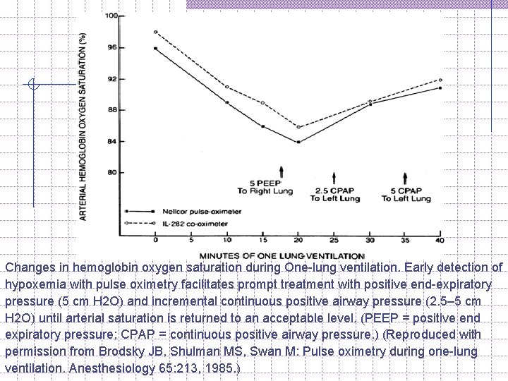 Changes in hemoglobin oxygen saturation during One lung ventilation. Early detection of hypoxemia with