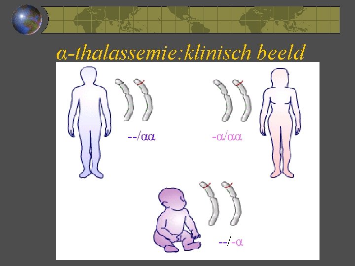 α-thalassemie: klinisch beeld --/αα -α/αα --/-α 